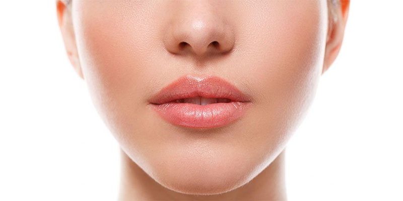 Lip Lift
