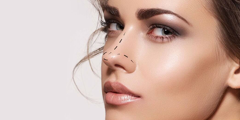 Revision Rhinoplasty