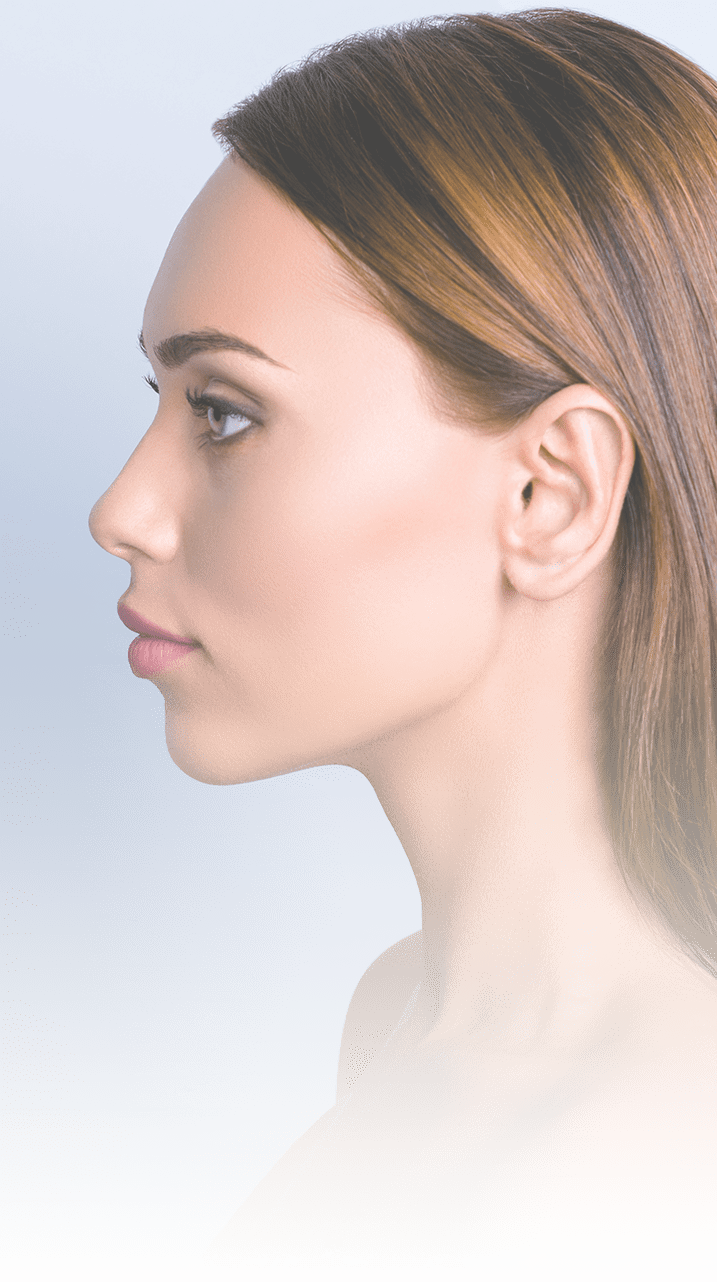 Rhinoplasty
